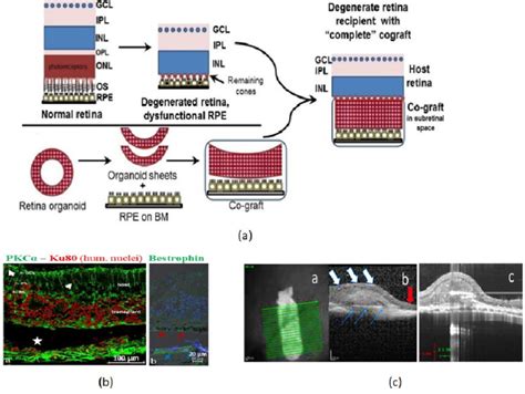 Tissue Engineered RPE Retinal Organoid Co Graft Transplantation Into