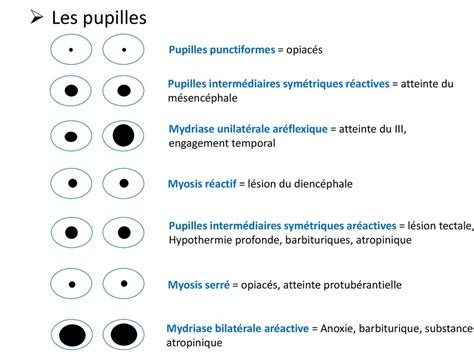 Lexipatho Coma Non Traumatique