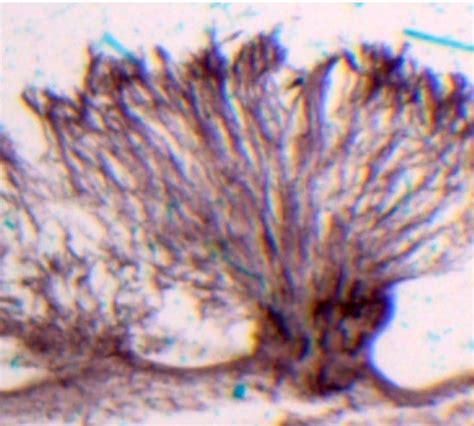 How to Confirm Mold with a Microscope - A Step-by-Step Guide