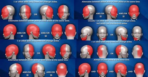 Location of Headache Meaning and Headache Placement Meanings on ...