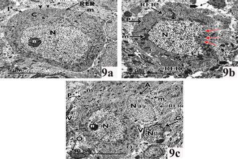 Transmission Electron Micrographs Of Cerebellar Cortex Of Pnd