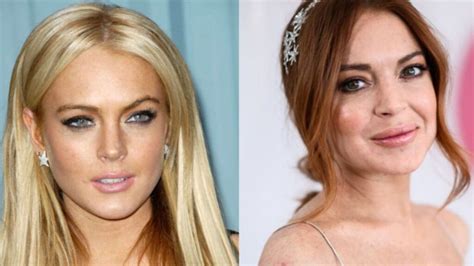 Did Lindsay Lohan Have Plastic Surgery How Does The Mean Girls Cast