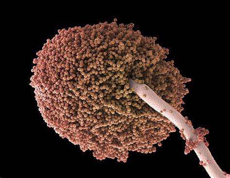 fungal infection spore fungal infectionspore  pccy