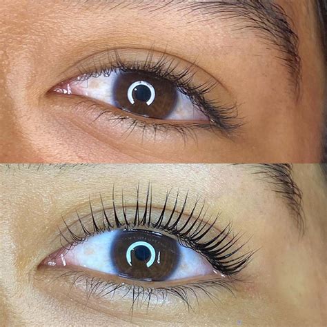 lash botox detailed guide   treatment