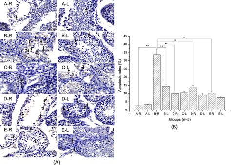 Testicular Cell Apoptosis Was Detected By Tunel Staining And Cell