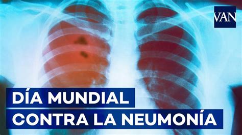 D A Mundial Contra La Neumon A Estos Son Los S Ntomas De La Enfermedad