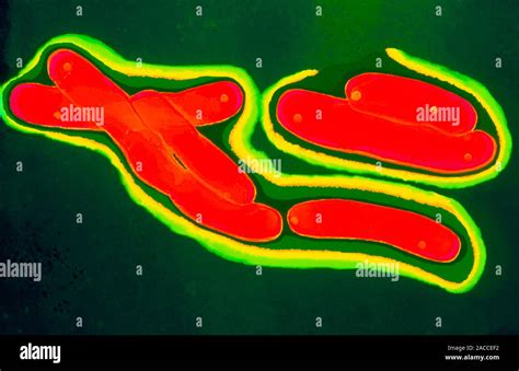 Mycobacterium tuberculosis bacteria. Coloured transmission electron ...