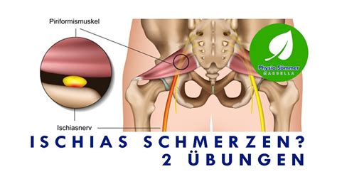 Ischias Schmerzen Piriformis Syndrom 2 Übungen YouTube