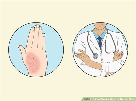 3 Ways to Treat a Wasp or Hornet Sting - wikiHow