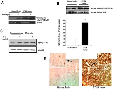 Western Blot Analysis Of A Total Protein Expression Of Nf κb P65 In