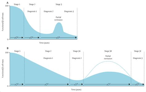 Stages Of Type 1 Diabetes Diagnosis And The Partial Remission Period