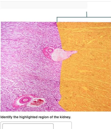 Solved Identify The Highlighted Region Of The Chegg