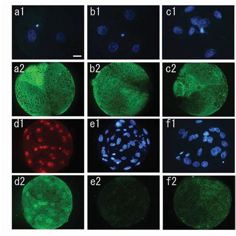 Localization And Expression Of Peptidylarginine Deiminase 4 PAD4 In