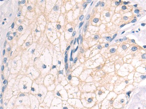 兔抗CLDN6多克隆抗体 Anti CLDN6 rabbit polyclonal antibody 生命科学产品与技术服务 生工生物工程