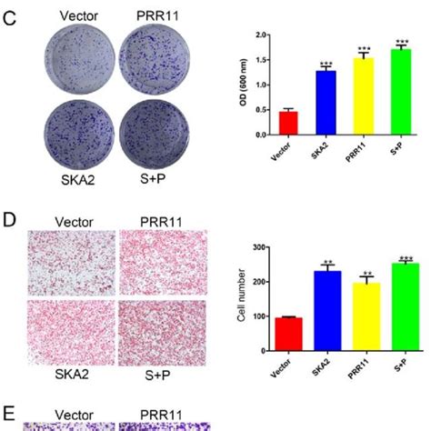 Prr11 Orand Ska2 Overexpression Promotes The Akt And Emt Signaling