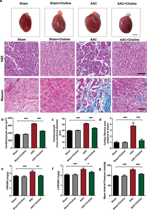 Amelioration Of Circadian Disruption And Calcium Handling Protein