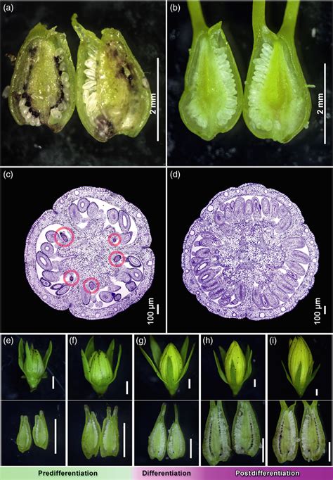 Sections Of Hypericum Perforatum Pistils A To D And Dissections Of