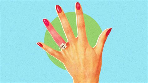 How To Get A Ring Off A Swollen Finger