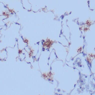 Treponema Pallidum Antibody - IVD Antibody for IHC - Zeta Corporation