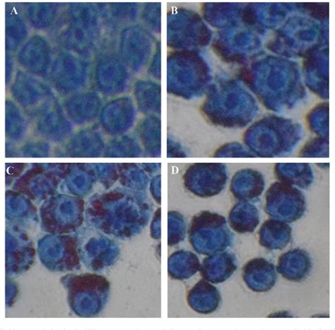 Figure 1 From Simvastatin Enhances Oxidized‑low Density Lipoprotein