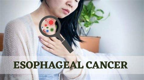 Esophagus Cancer Symptoms Causes Diagnosis