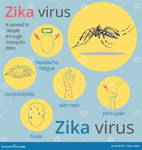 Zika Virus Symptoms Infographics Stock Vector Illustration Of Fever