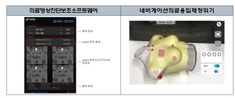 식약처 첨단기술 혁신의료기기 2개 추가 지정