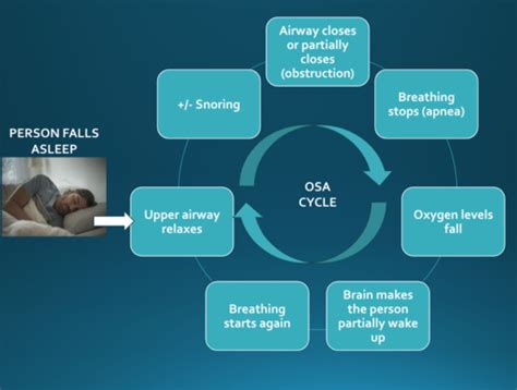 Obstructive Sleep Apnea Flashcards Quizlet