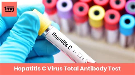 Hepatitis C Virus Total Antibody (HCV Ab): Purpose & Normal Range of ...