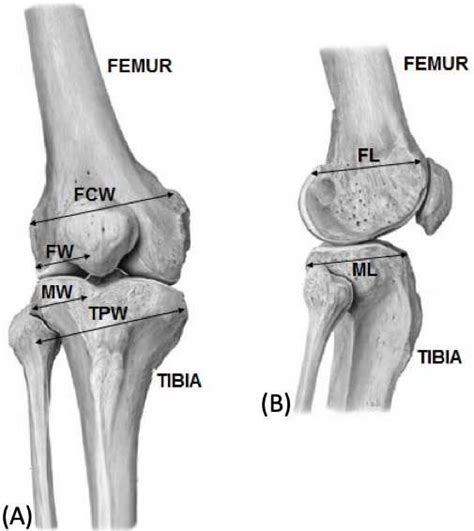 Lateral Femoral Condyle