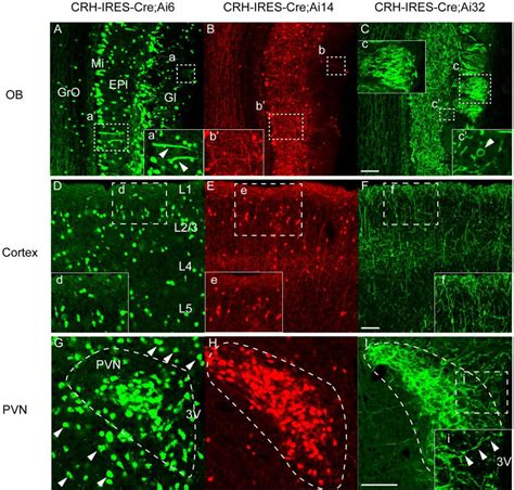 Visualizing Dendritic Characteristics Of Corticotropin Releasing