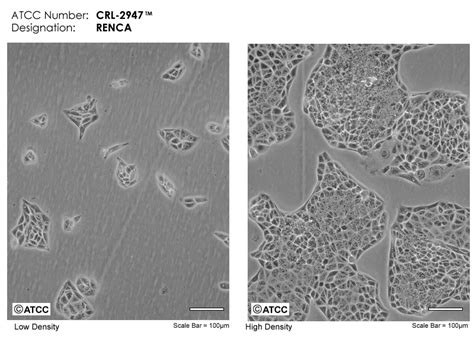 Renca细胞ATCC CRL 2947细胞 RENCA小鼠肾腺癌细胞株购买价格培养基培养条件细胞图片特征等基本信息 生物风