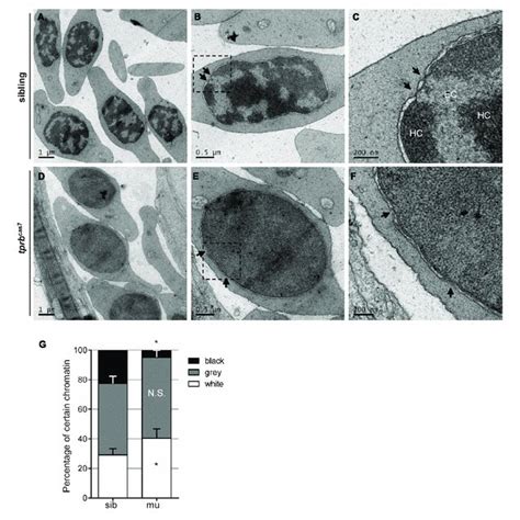 Chromatin Condensation Is Defective In Tprb Cas Mutant Erythroid