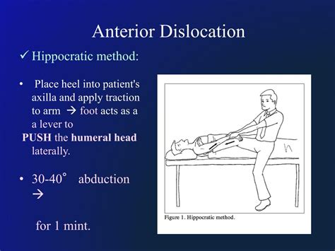 Ppt Shoulder Dislocation Powerpoint Presentation Free Download Id