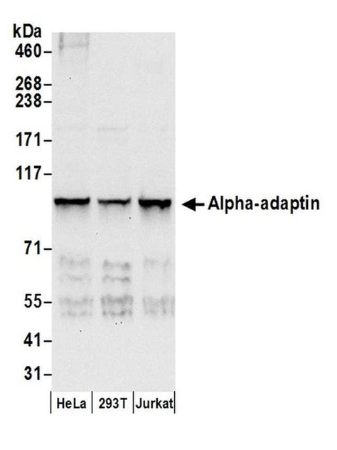 Alpha Adaptin Polyclonal Antibody A304 721a T