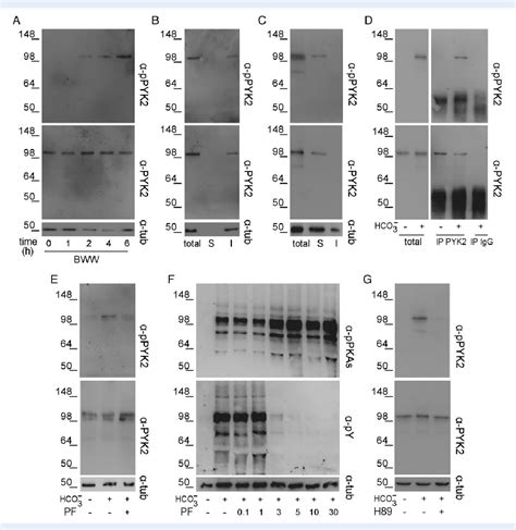 Figure From Evidence For The Involvement Of Proline Rich Tyrosine