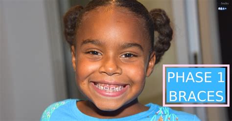 Phase 1 Braces: What It Means For Your Child | ProSmiles Orthodontics