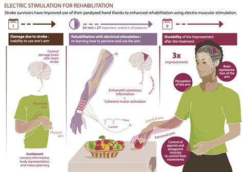 Stroke Patient Arm