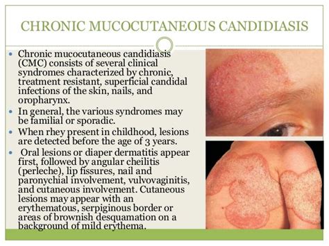 Candidiasis