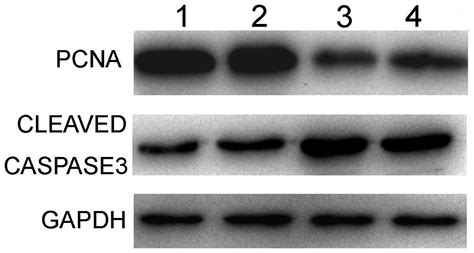 Suicide Gene Therapy For Hepatocellular Carcinoma Cells By Survivin