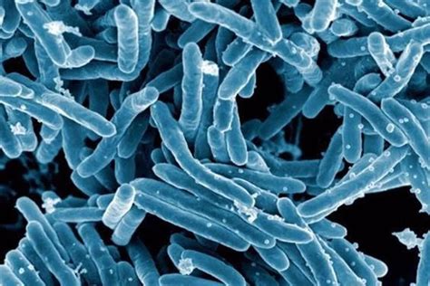 Esta Es La Bacteria Que Produce Uno De Los Cánceres Más Mortales En El