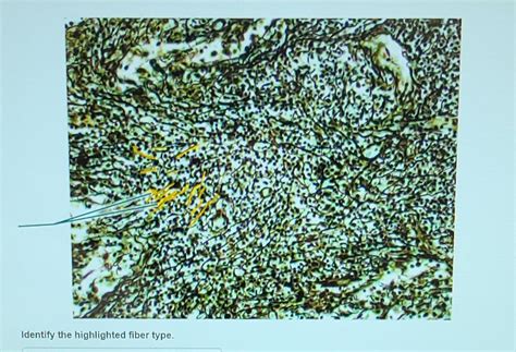 Solved Pal Histology Connective Tissue Lab Practical Chegg