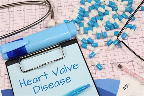 Free Of Charge Creative Commons Heart Valve Disease Image Medical 8