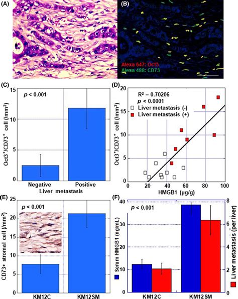 Effect Of Hmgb1 On Crc Liver Metastasis A Invasive Front Of A Crc