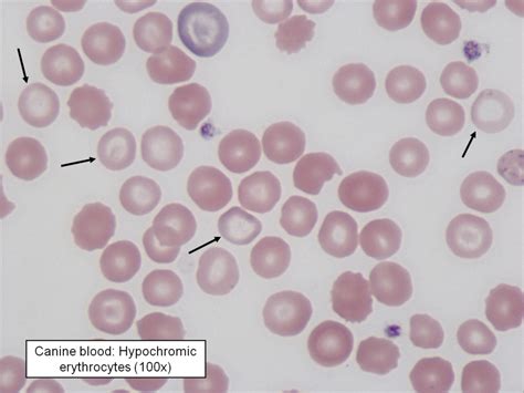 Human Physiology – Hematology and Characteristics of Blood Cells ...