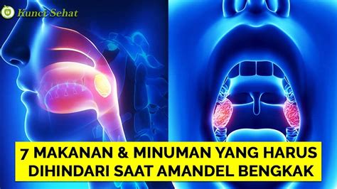 Gambar Amandel Sehat Dan Tidak Sehat Pulp