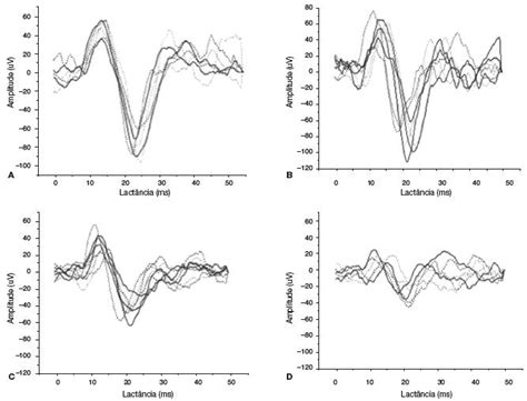 Scielo Brasil Reproducibility Test Retest Of Vestibular Evoked