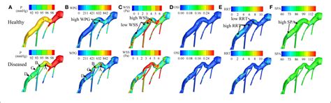 Figure 1 From Application Of Patient Specific Computational Fluid