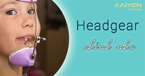 Những điều Quan Trọng Cần Biết Về Headgear Chỉnh Nha Nha Khoa Quốc Tế