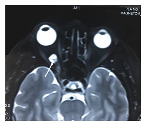 Computed Tomography Ct And Magnetic Resonance Imaging Mri Of The Download Scientific